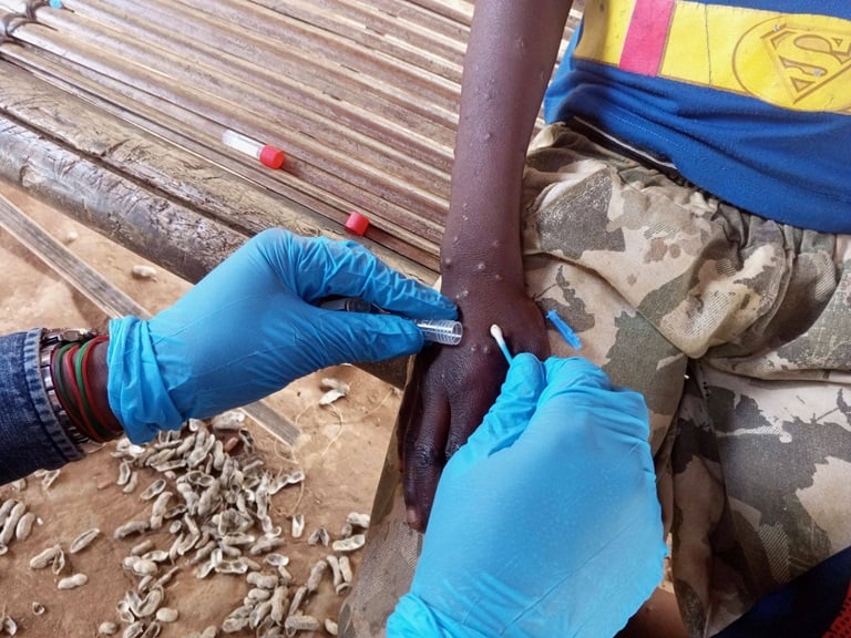 Global mobilization for mpox emergency begins to take shape